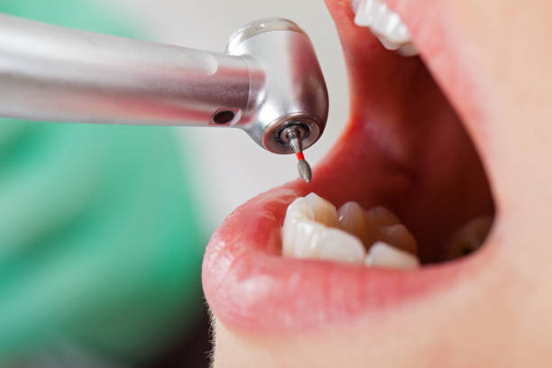 Best Emergency Denture Repair in Waynesville, NC